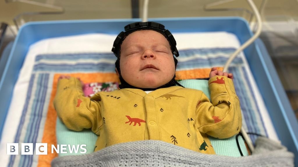 Cambridge ‘swimming cap’ brings hope for brain-injured babies Cambridge 'swimming cap' brings hope for brain-injured babies