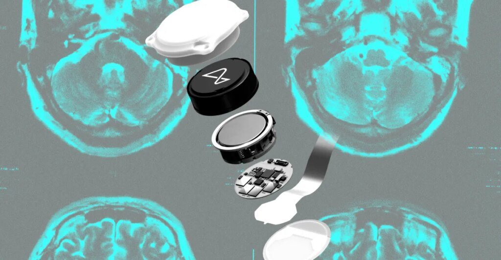 Did Neuralink make the mistaken guess? Did Neuralink make the wrong bet?