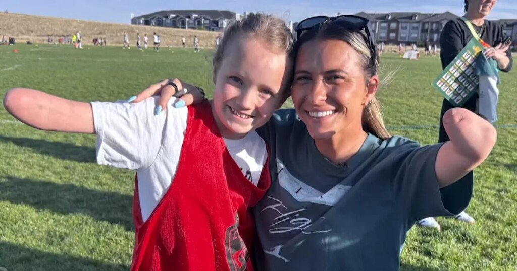 How a girl born without most of her arm was inspired by a Denver soccer player just like her