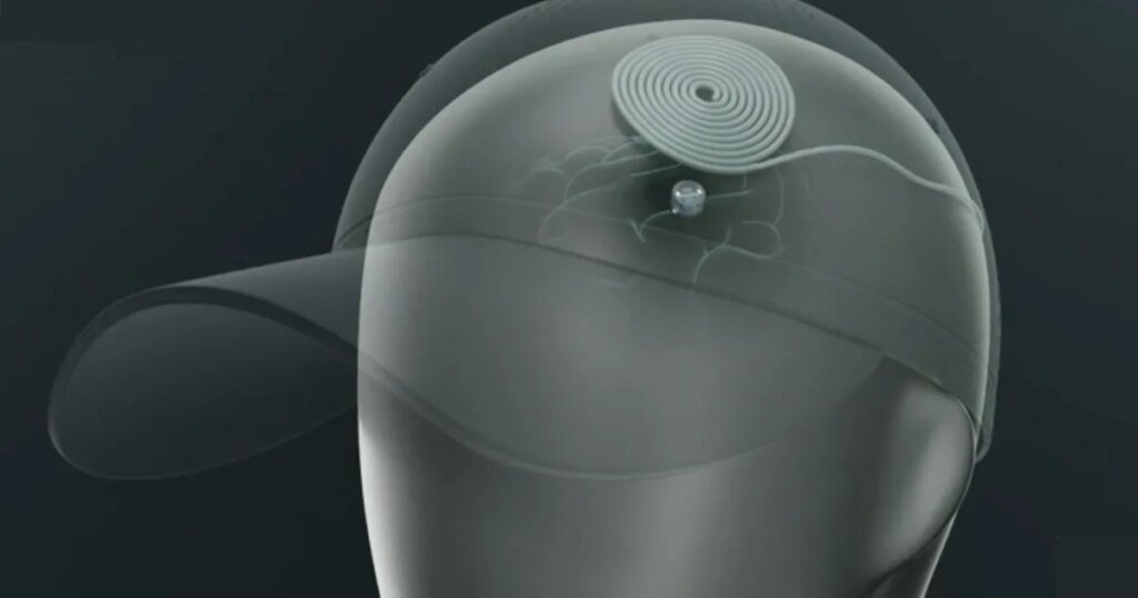 This tiny brain implant could treat depression at home