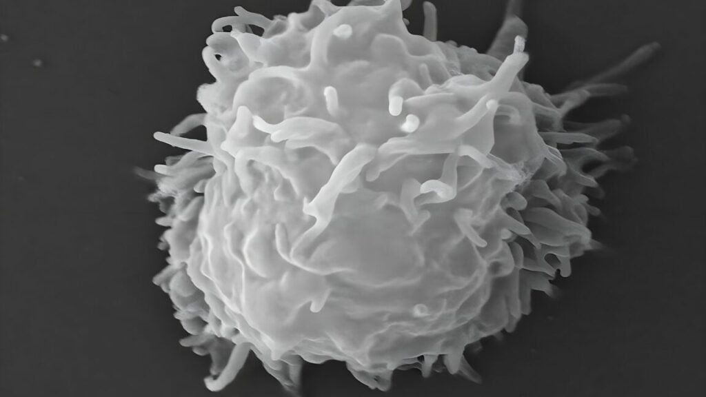 Man dies covered in necrotic lesions after amoebas eat him alive